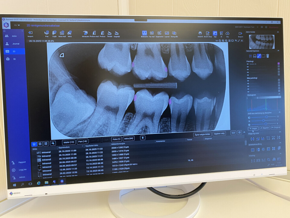 Område med mistenkt karies vert rosa på røntgenbileta.